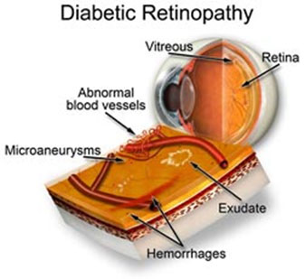 What is the Retina